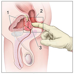 point p prostate