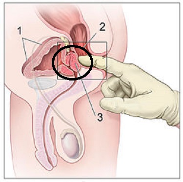 comment stimuler la prostate